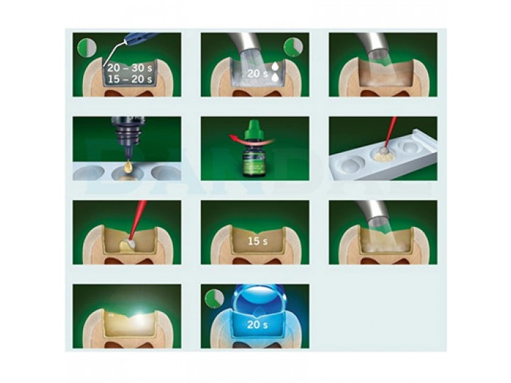 Глюма 2Бонд - Gluma 2Bond