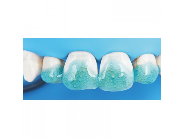 Протравочный гель - Etching Gel  37%