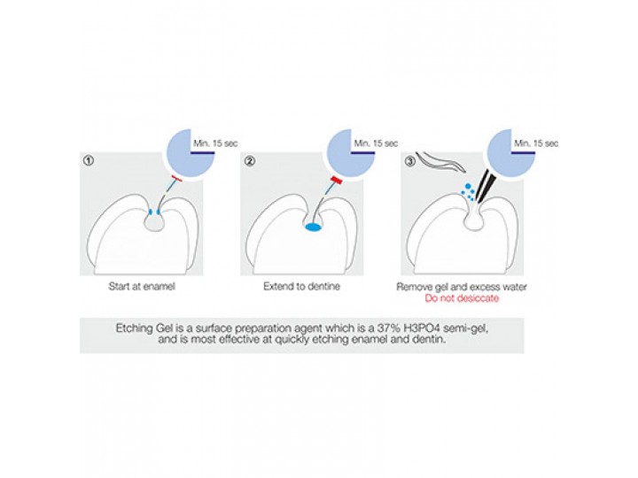 Протравочный гель - Etching Gel  37%