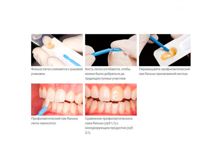 Профилактический лак Flairesse (35 доз х 0,4 мл) арт. 220404