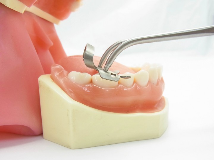 Щипцы для фиксаторов, 08121