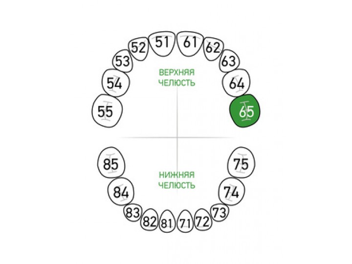 Кламп № 65-Matt Dentech