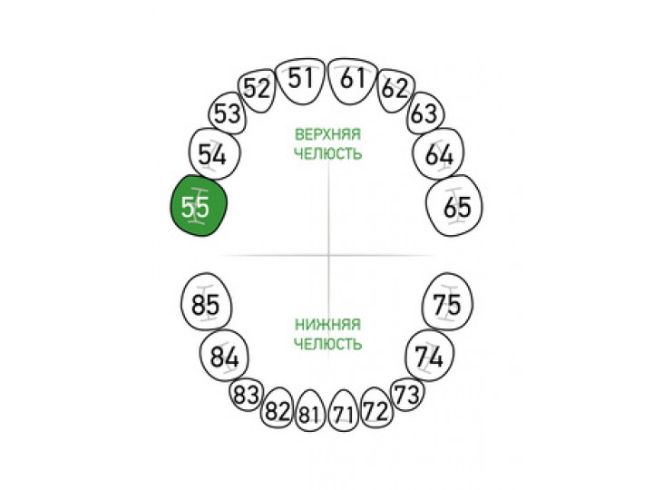 Кламп № 55-Matt Dentech