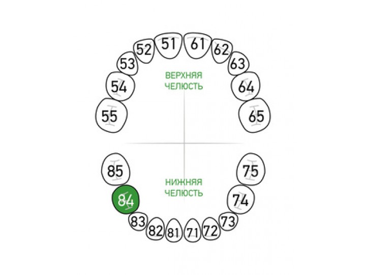 Кламп № 84-Matt Dentech
