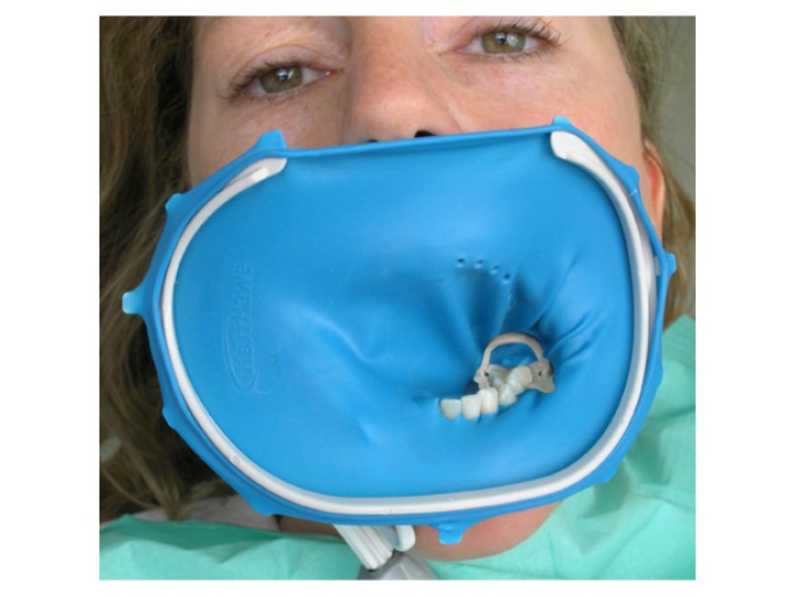 Доп.набор оптиДам Постериор 5201 - OptiDam Posterior Refill