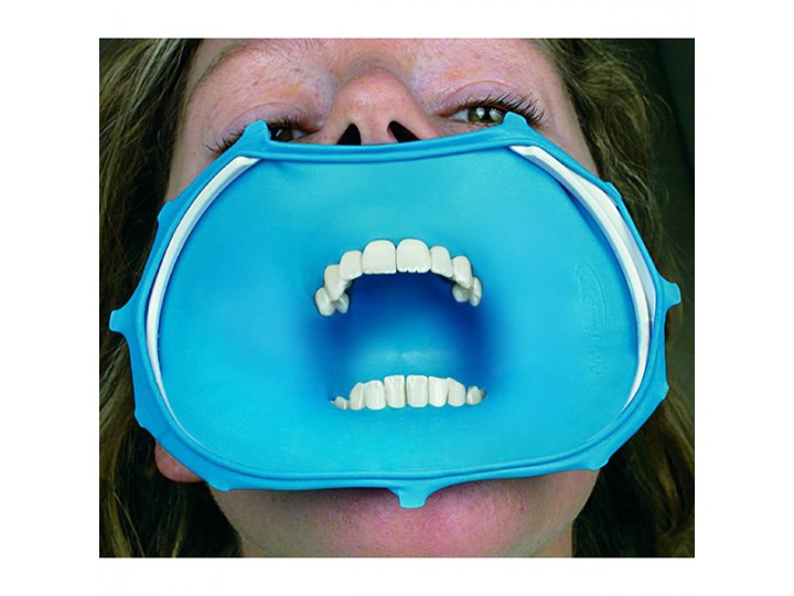 Доп.набор оптиДам Антериор 5204 - OptiDam Anterior Refill