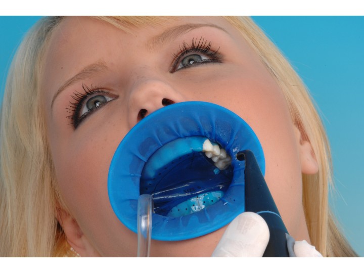 Оптра Дам Плюс - OptraDam Plus