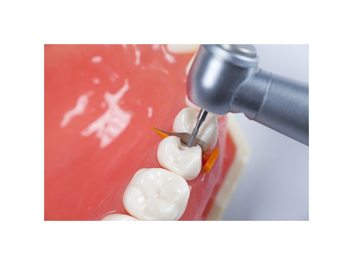 Набор клиньев с матрицей FenderWedge Kit