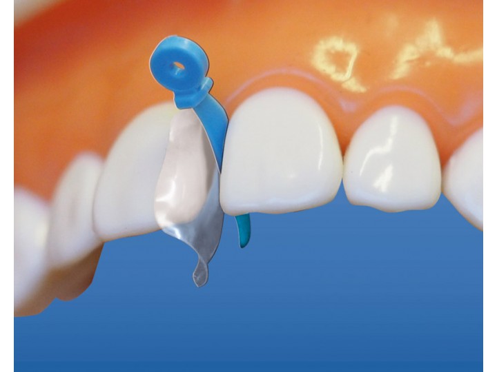 Клинья фиксирующие изолирующие 1.875