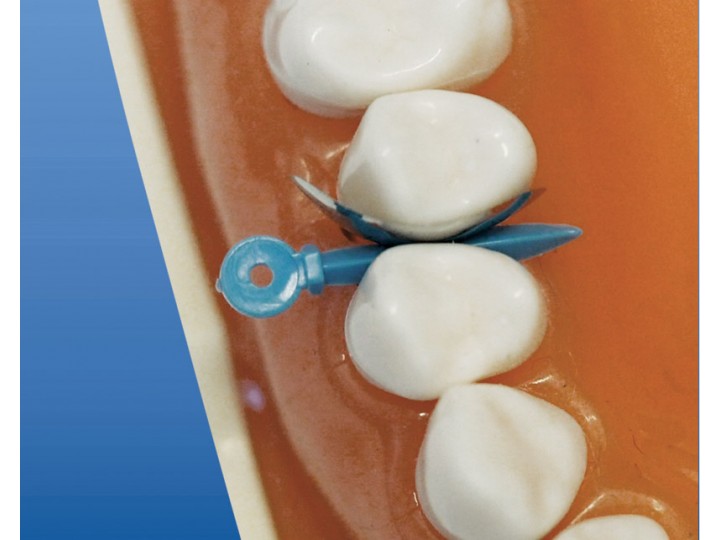 Клинья фиксирующие изолирующие 1.875