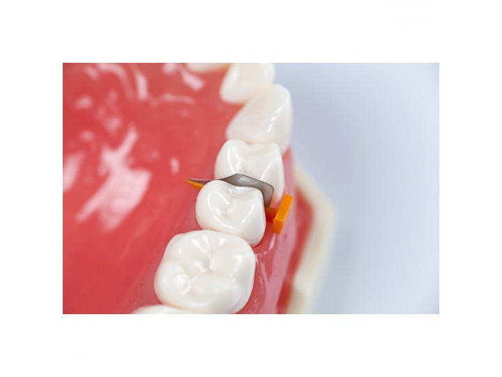 Клинья с матрицей FenderWedge