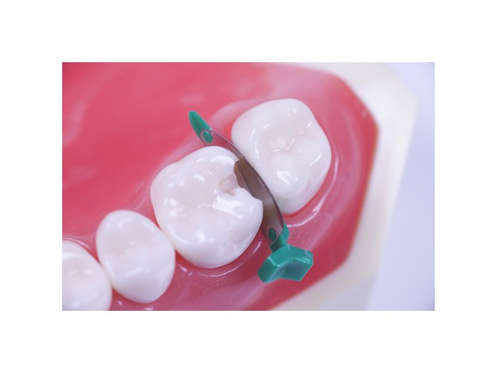 Клинья с матрицей FenderMate