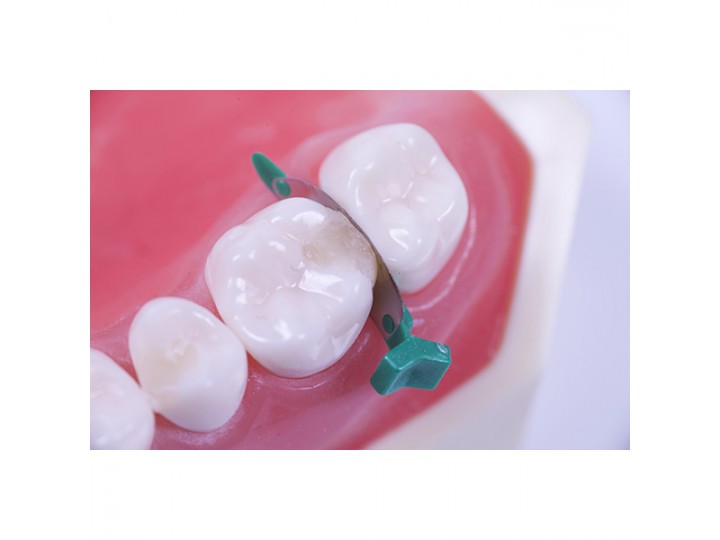 Клинья с матрицей FenderMate