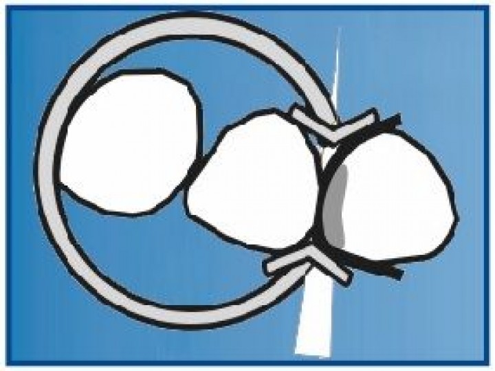 Кольцо фиксирующее 1.167