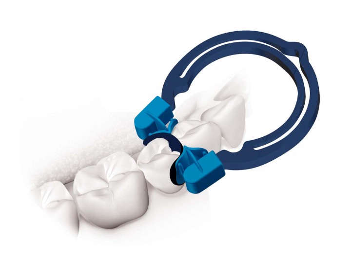 Стартовый комплект myQuickmat Forte +2 шт. myRing Форте