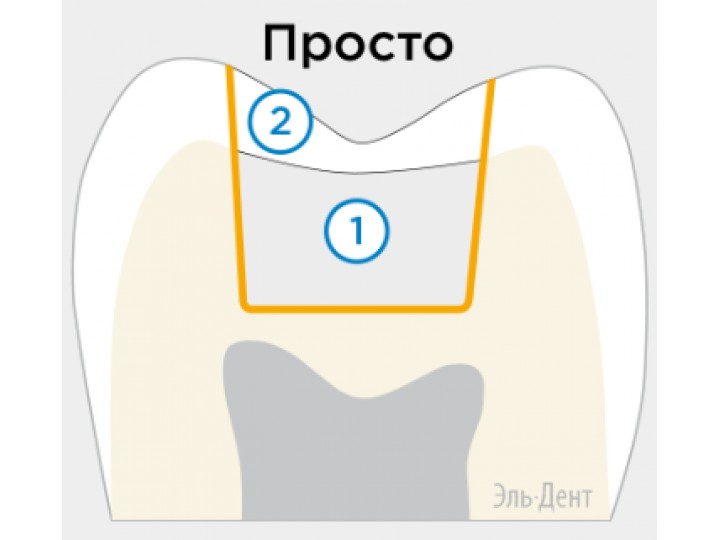 СДР Плюс малый набор 45 к - SDR Plus Bulk Fill Flowable Intro Kit, 60603047,Dentsply