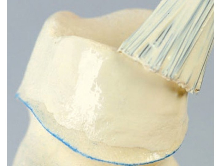 Лак компенсационный дентинный, 10 мкм 18 мл