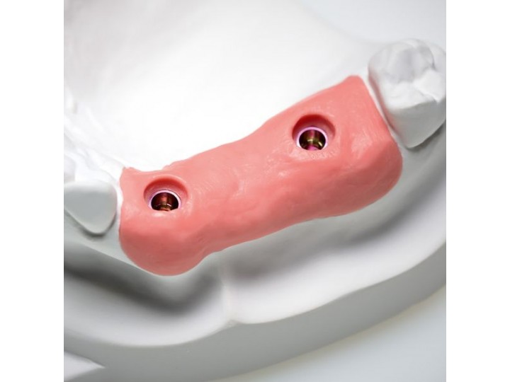 Десневая маска Гингифаст - Gingifast Rigid