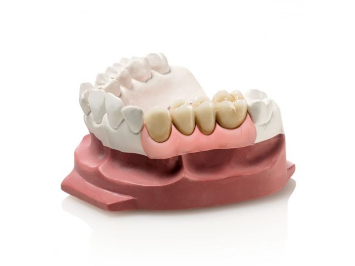 Десневая маска Гингифаст - Gingifast Elastic